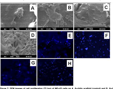  Zeolite: Biocompatible Ceramics for Advanced Bone Regeneration Techniques!