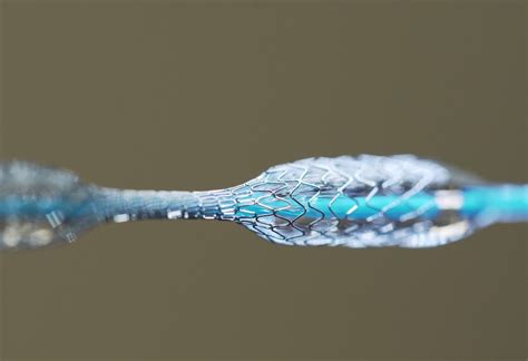  Nitinol: Superalliage à Mémoire de Forme pour Applications Médicales Innovantes !